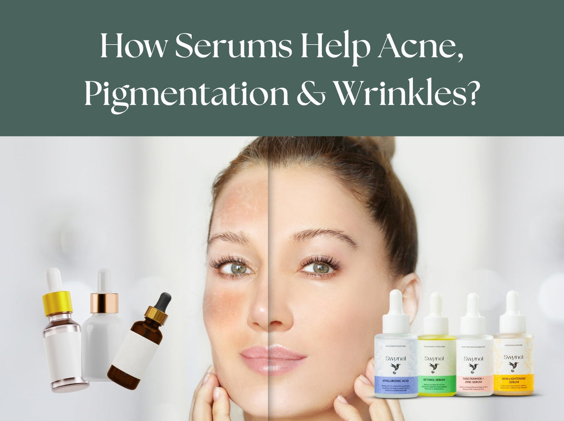 How Serums Help Acne, Pigmentation & Wrinkles | Swynol
