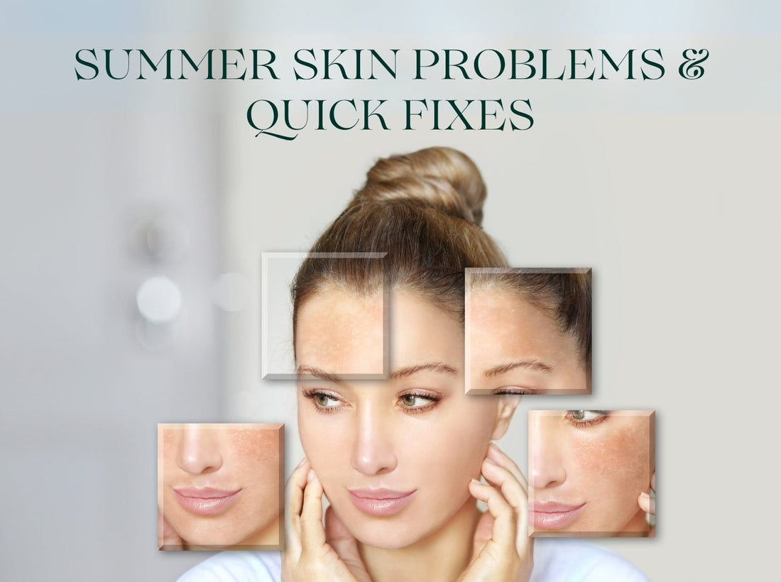 Summer Skin Problems & Quick Fixes | Swynol Skincare PK