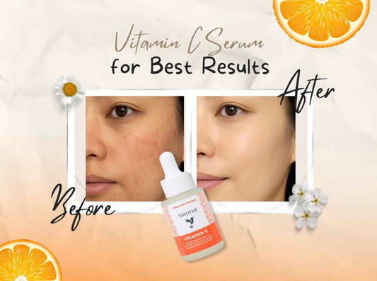 Store Swynol Vitamin C Serum for Best Results