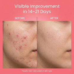 Rapid Repair Facewash