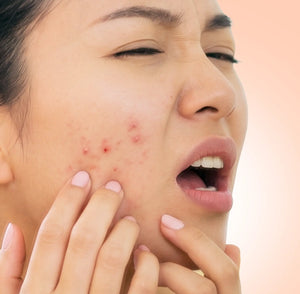 Breakouts