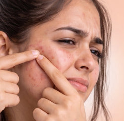 Moisturizer with SPF 35
